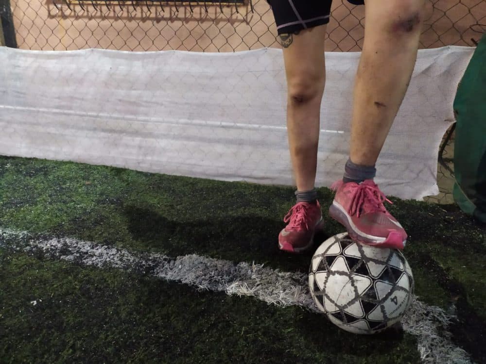 La vuelta de las rodillas raspadas